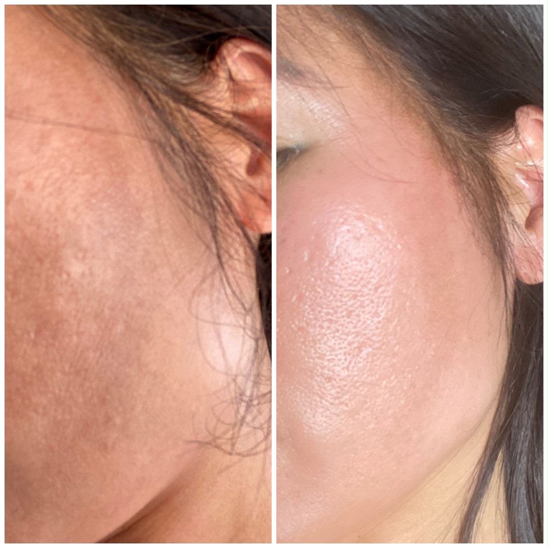 Niacinamide 10% + Zinc 1% Serum