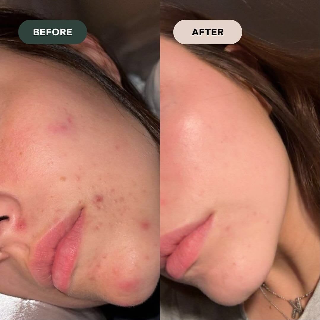 Vitamin C Brightening Face Wash