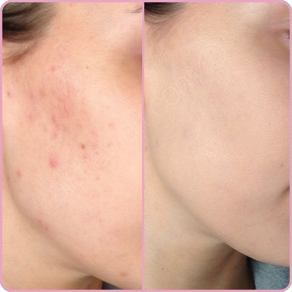 Vitamin C Brightening Face Wash