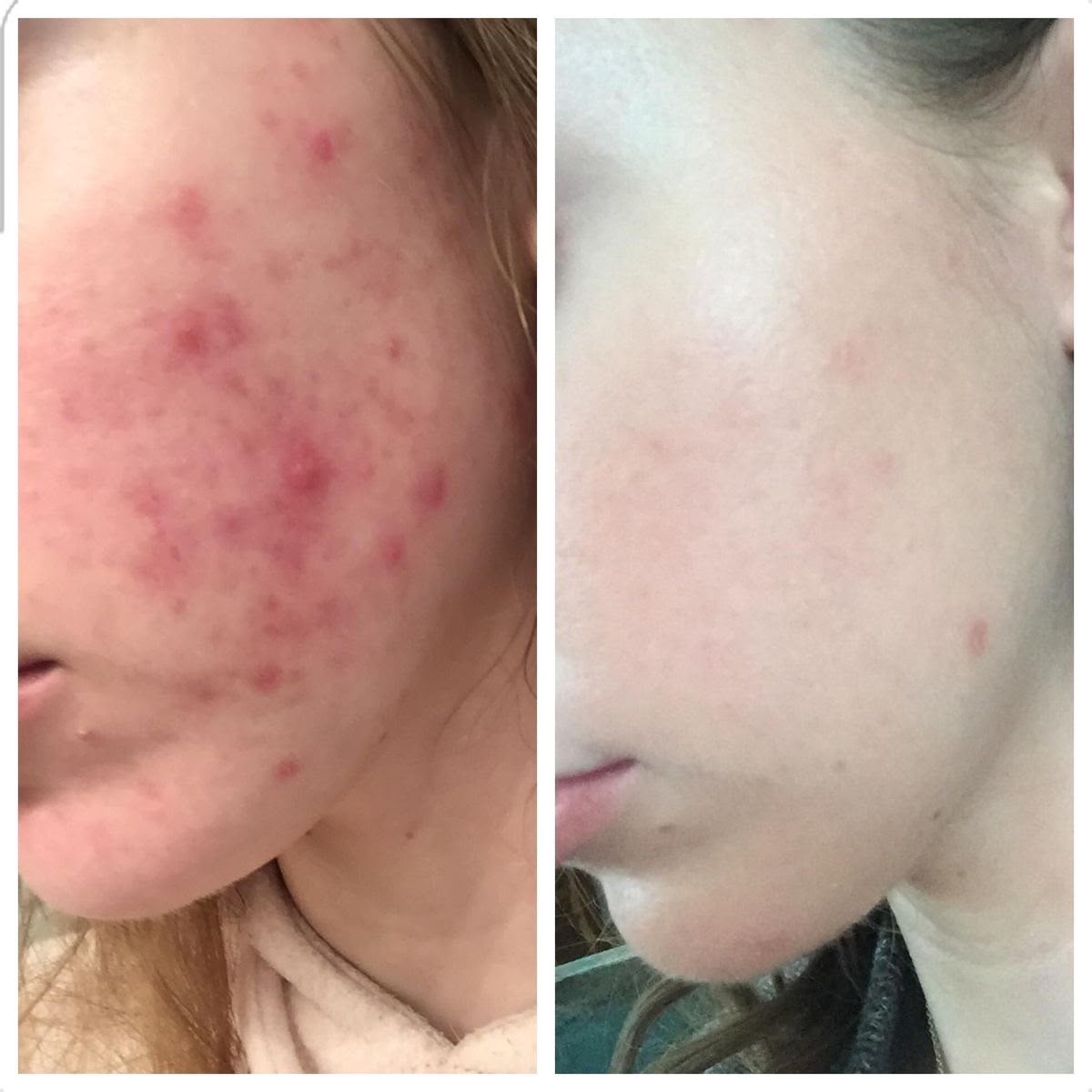 Vitamin C Brightening Face Wash