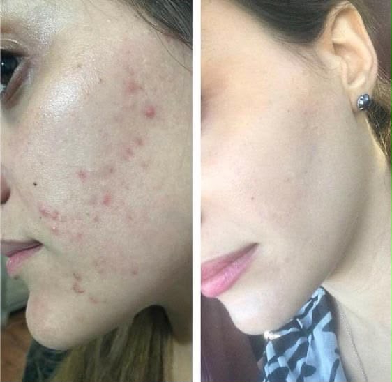 Vitamin C Brightening Face Wash