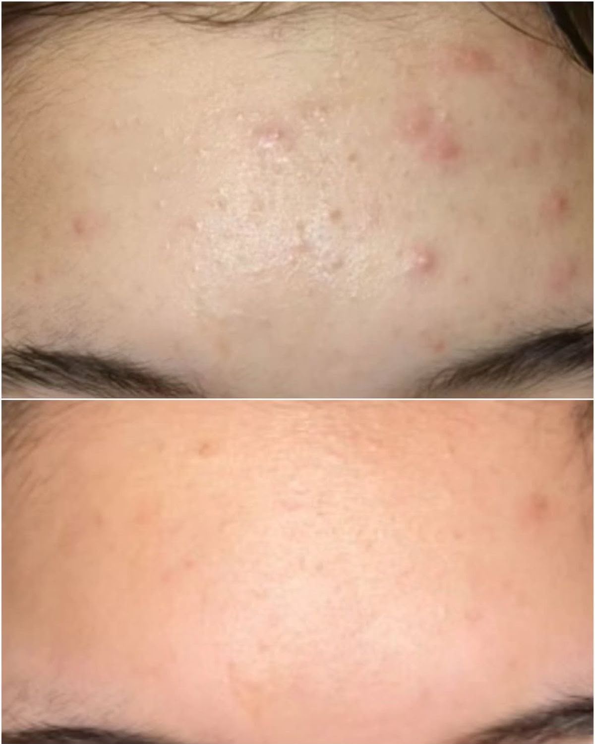 Niacinamide 10% + Zinc 1% Serum