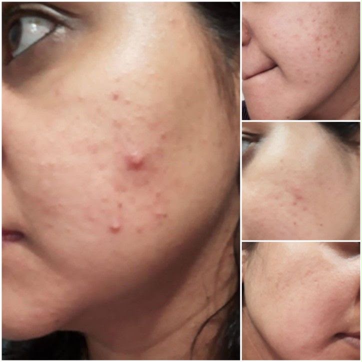 Vitamin C Brightening Face Wash