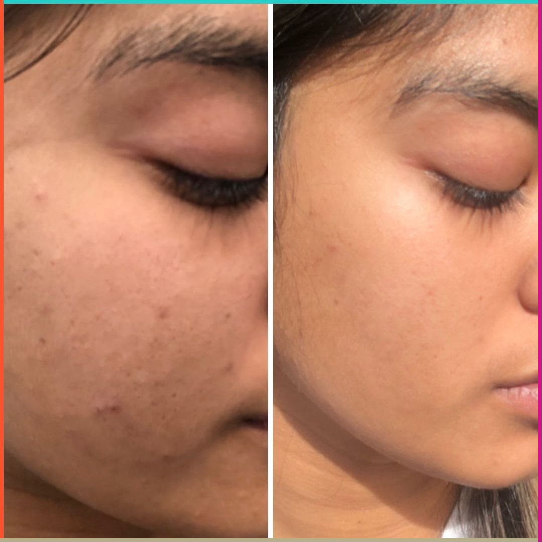 Niacinamide 10% + Zinc 1% Serum