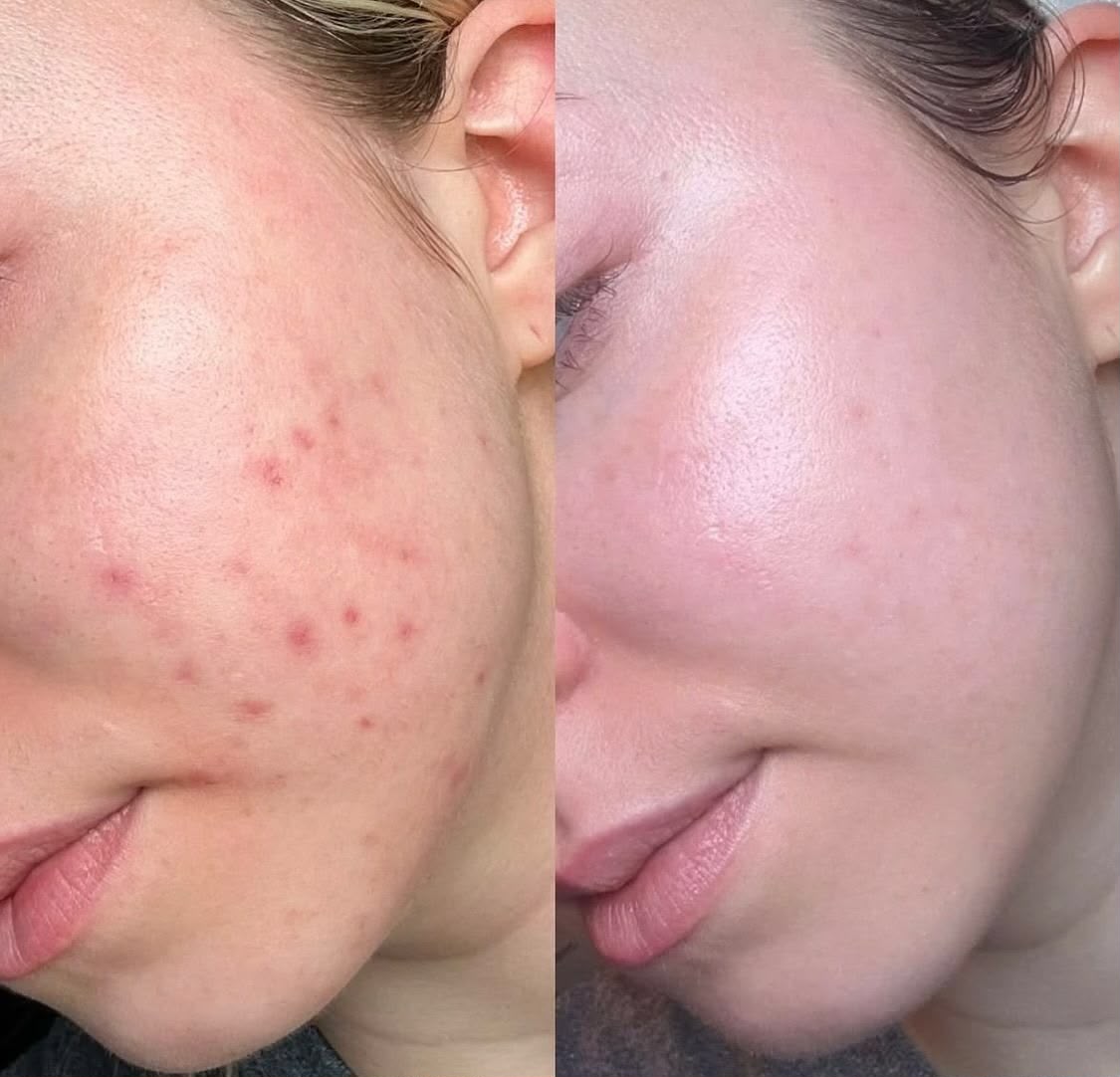 Vitamin C Brightening Face Wash