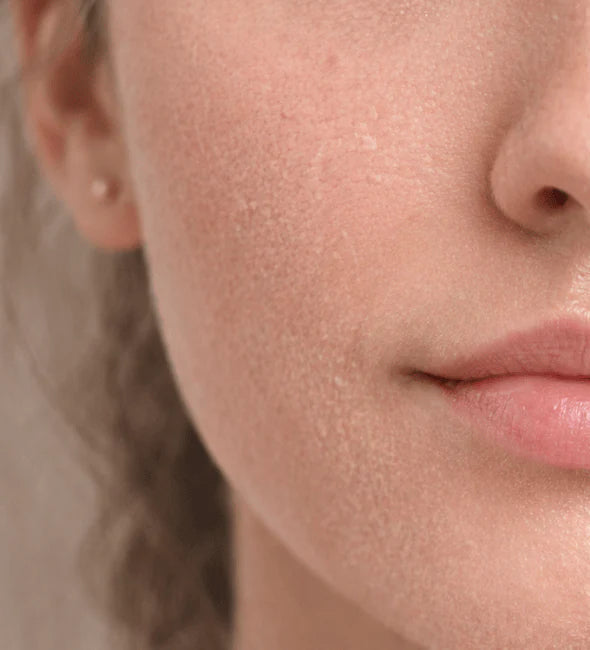 Side-by-side comparison of a woman's face with and without a skincare product application.
